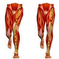 muscle diagram