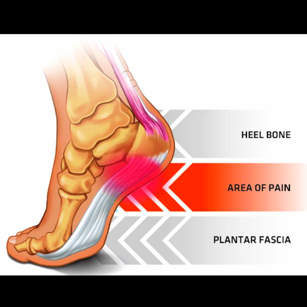 foot pain chart