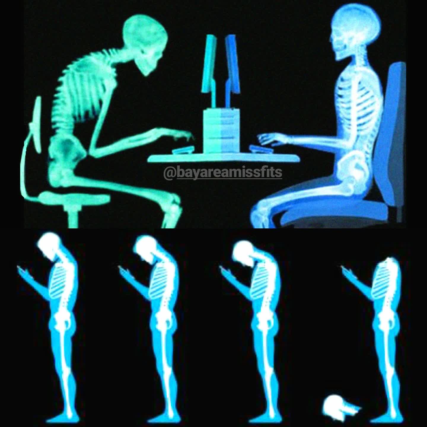 Bad posture graphic